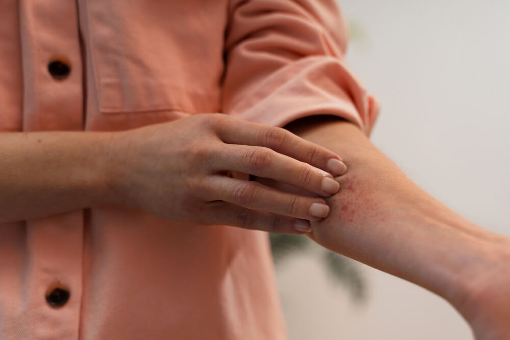 moles evaluation at FDL Dermatology in Arlington VA