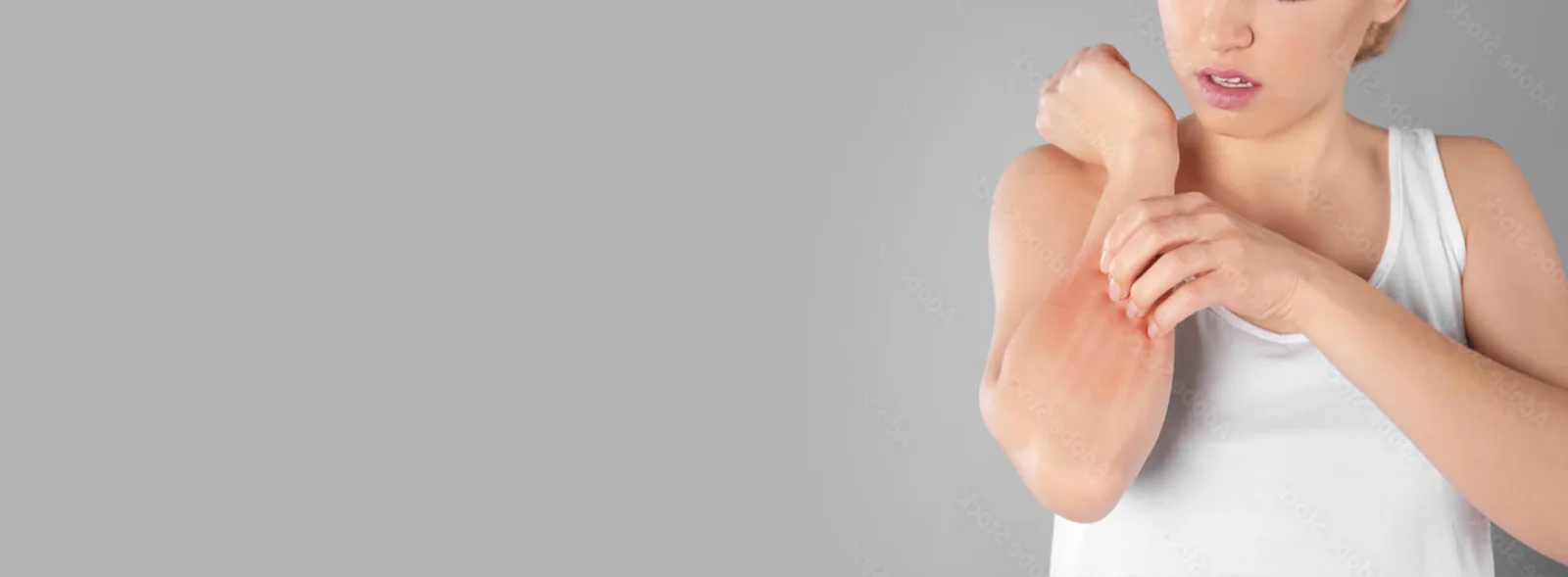 moles evaluation at FDL Dermatology in Arlington VA